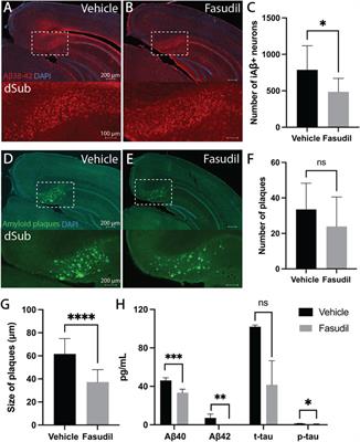 Combined targeting of pathways regulating synaptic formation and autophagy attenuates Alzheimer’s disease pathology in mice